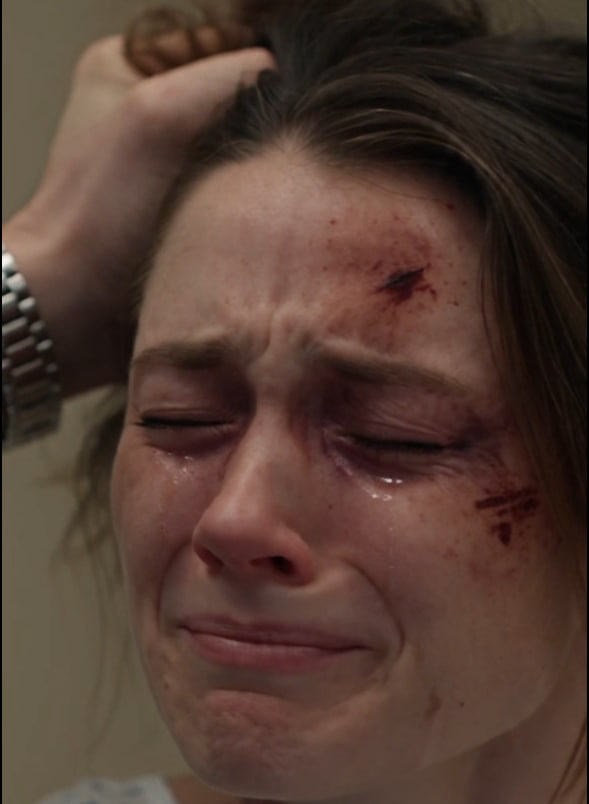 My Father Walked Into My Hospital Room And Saw Bruised Fingerprints Around My Neck—Then My Husband Smirked And Admitted Exactly What He Had Done.